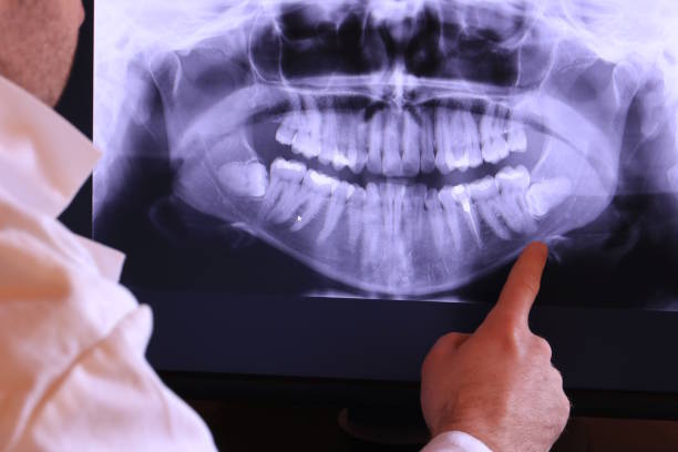 Best Emergency TMJ Treatment in Medical Lake, WA