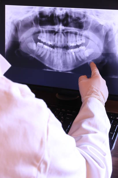 Best Urgent Care for Lost Fillings or Crowns in Medical Lake, WA