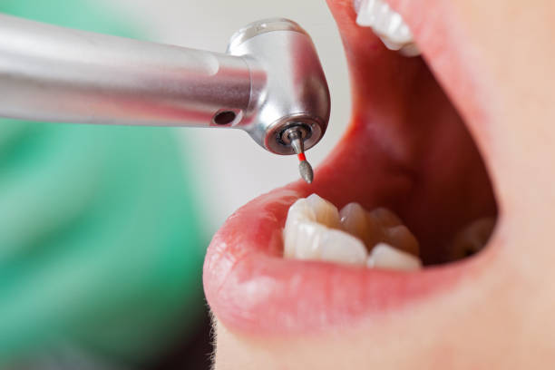 Best Emergency Dental Care for Broken or Chipped Teeth in Medical Lake, WA